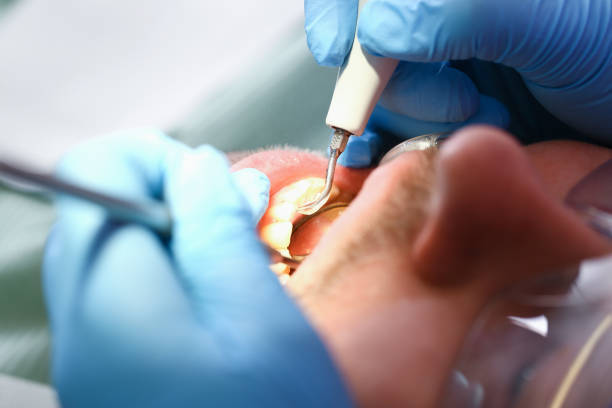 Best Emergency Tooth Extraction in White Oak, PA