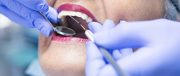 Best Emergency Dental Care for Broken or Chipped Teeth in White Oak, PA